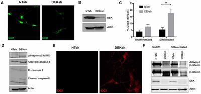 Loss of DEK Expression Induces Alzheimer’s Disease Phenotypes in Differentiated SH-SY5Y Cells